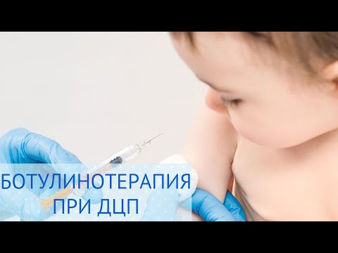 Видео: 💉 Ботулинотерапия при ДЦП