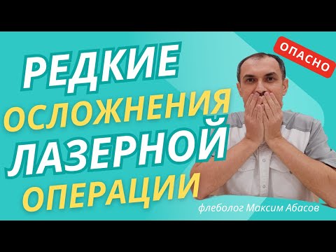 Видео: Об этом не расскажут врачи. Флеболог Москва.