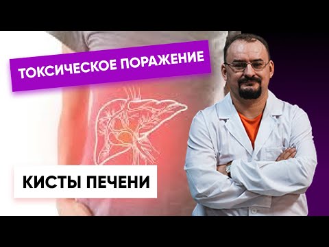 Видео: Токсическое поражение печени. Кисты печени