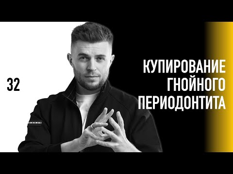 Видео: Уроки эндодонтии. Купирование гнойного периодонтита