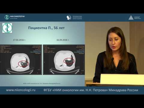 Видео: Разбор клинических случаев. Опыт НИИ онкологии им. Н.Н. Петрова и лечебных учреждений С-З. региона.