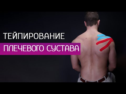 Видео: Терапия боли в плече - тейпирование