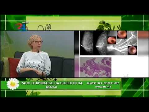 Видео: „Рано откривање на болести на дојка“.  - Д-р Наде Петановска