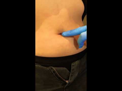 Видео: Правильно проколоть пупок