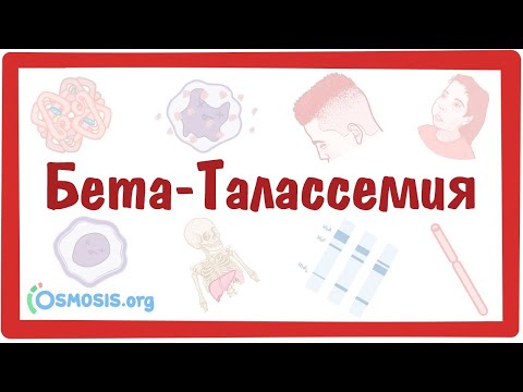 Видео: Бета-Талассемия — причины, симптомы, патогенез, диагностика, лечение