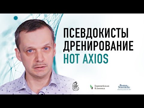 Видео: Дренирование кист поджелудочной железы. Hot Axios