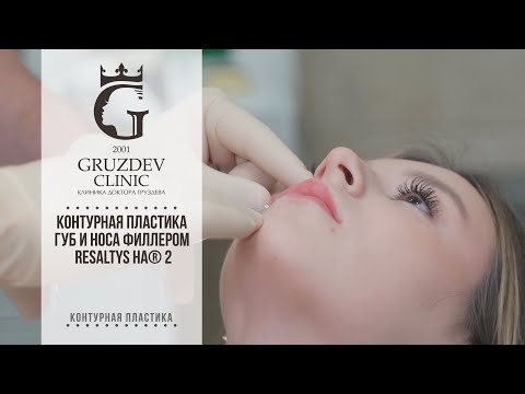 Видео: Контурная пластика губ и носа филлером RESALTYS HA® 2