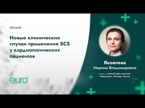 Видео: Новые клинические случаи применения SCS (стимуляции спинного мозга) у кардиологических пациентов