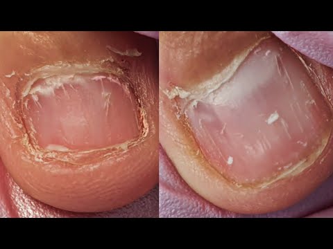 Видео: СЛОЖНЕЙШИЙ случай для мастера🤒🤯/преображение обгрызаных ногтей