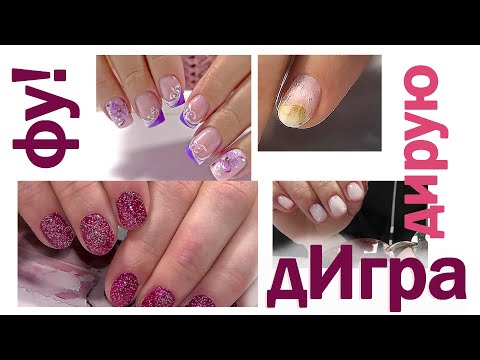 Видео: Козявки на ногтях. Онихолизис уже отрос!