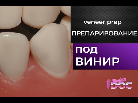 Видео: ПРЕПАРИРОВАНИЕ ПОД ВИНИР (подробная инструкция)