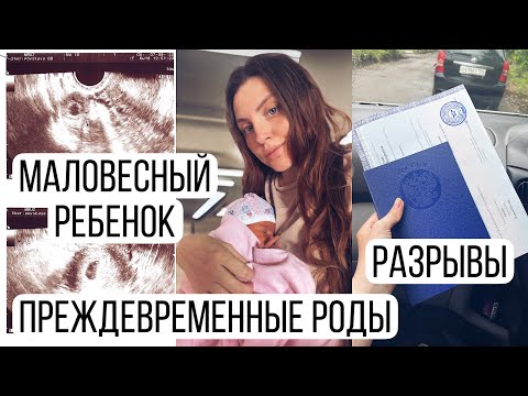 Видео: Моя история беременности и родов. Преждевременные роды. Диплом в декрете.