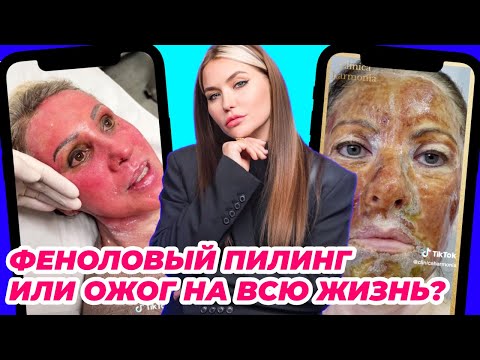 Видео: Пилинг, который сжигает лицо