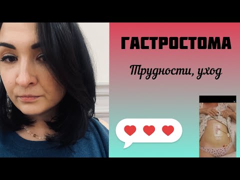 Видео: РАК НОСОГЛОТКИ. ГАСТРОСТОМА. МОЙ ОПЫТ.