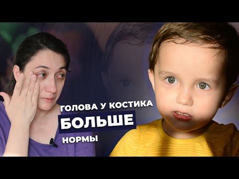 Видео: МАЛЬФОРМАЦИЯ ВЕНЫ ГАЛЕНА | История Кости Карасёва