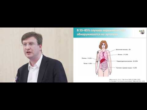 Видео: Опухоли без выявленного первичного очага: основные понятия и определения