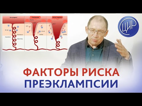 Видео: Факторы риска преэклампсии. Гены, увеличивающие риск преэклампсии. Гузов И.И.