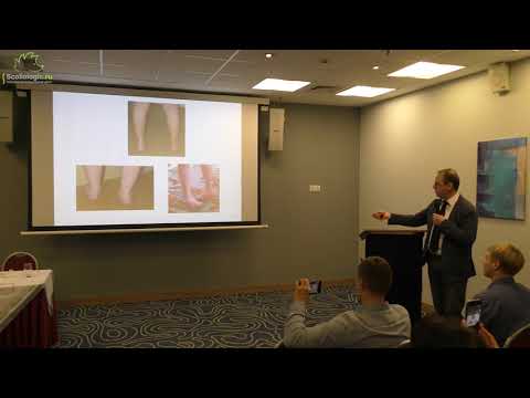 Видео: Мастер класс Кениса В М  «Патогенетические принципы коррекции деформации стоп у детей с ДЦП»