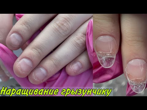 Видео: Наращивание на обкусанные ногти/Самый быстрый способ