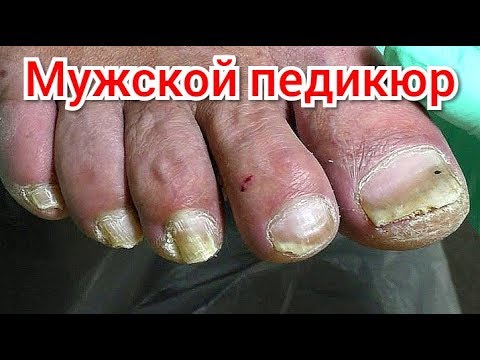 Видео: Аппаратный Педикюр/ Виктория Авдеева