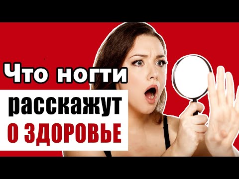 Видео: Ногти зеркало здоровья - расшифровка состояния