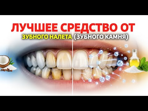 Видео: Лучшее средство от зубного налета (зубного камня)