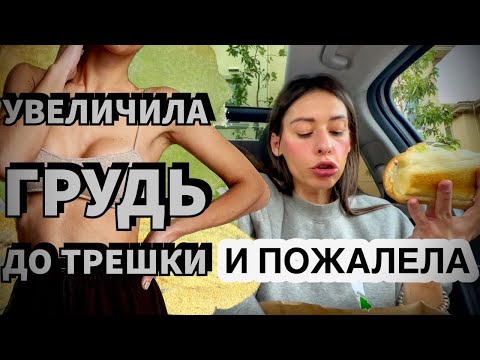 Видео: ЖИЗНЬ С ИМПЛАНТАМИ СПУСТЯ ГОДЫ | ПРИНЯТИЕ СЕБЯ | ИСТОРИЯ МОЕЙ МАММОПЛАСТИКИ |
