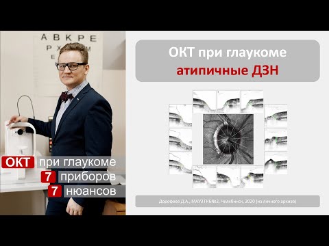 Видео: ОКТ при глаукоме. Атипичные ДЗН