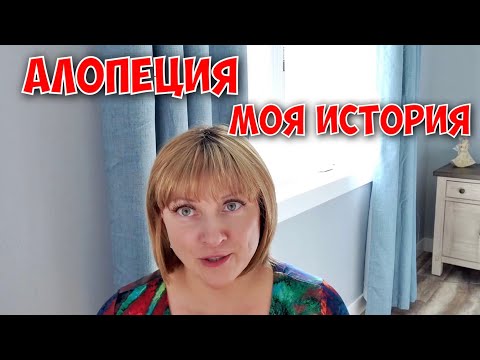 Видео: Алопеция. Моя история. Плюсы и трудности, с которыми я столкнулась.