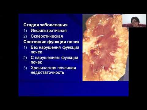 Видео: Пиелонефрит у детей