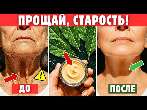 Видео: Лавровый Лист — Сильнее Ботокса, Устраняет Морщины Даже После 70 Лет