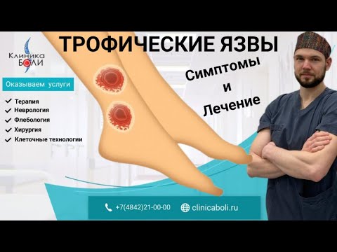 Видео: ТРОФИЧЕСКИЙ ЯЗВЫ: Симптомы и лечение