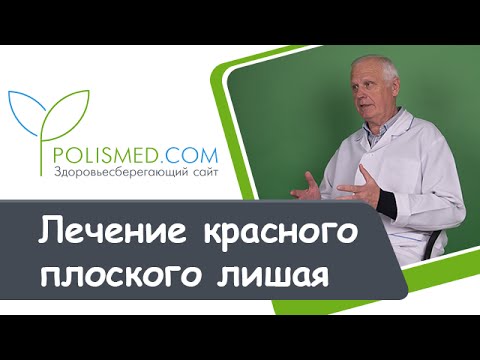 Видео: Лечение красного плоского лишая