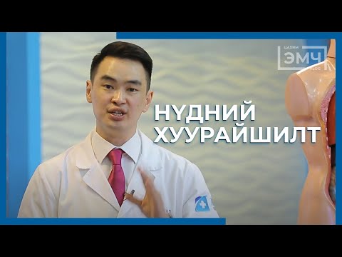 Видео: 216 - Нүдний хуурайшилт
