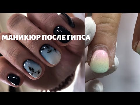 Видео: Маникюр после перелома. Как выглядят ногти под гипсом.