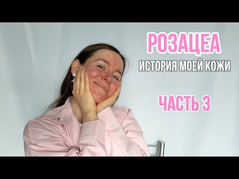 Видео: РОЗАЦЕА. ИСТОРИЯ МОЕЙ КОЖИ. ЧАСТЬ 3: КОЖА СЕЙЧАС