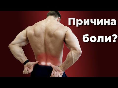 Видео: Болит ПОЯСНИЦА?  Причина НЕ в СПИНЕ!