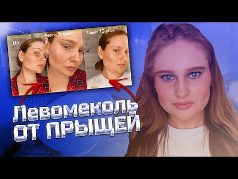 Видео: Мазь ЛЕВОМЕКОЛЬ от прыщей: мой опыт использования, мои ошибки и результаты