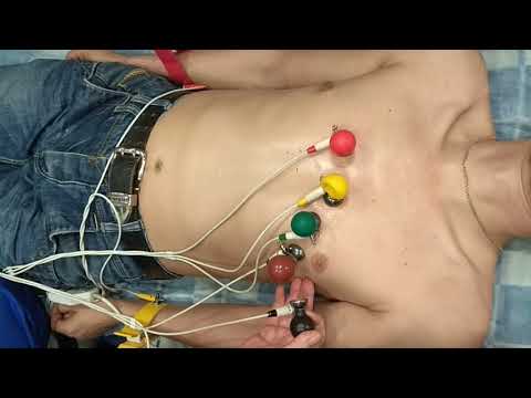 Видео: РЕГИСТРАЦИЯ СТАНДАРТНОЙ ЭКГ