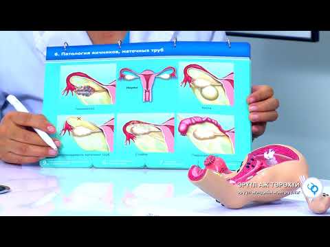 Видео: Юнимед Интернейшнл эмнэлгийн эмэгтэйчүүд, үргүйдлийн нарийн мэргэжлийн их эмч Л.Амарзаяа