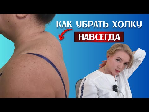 Видео: Как убрать вдовий горб на шее при помощи горячей воды и деревянной ложки