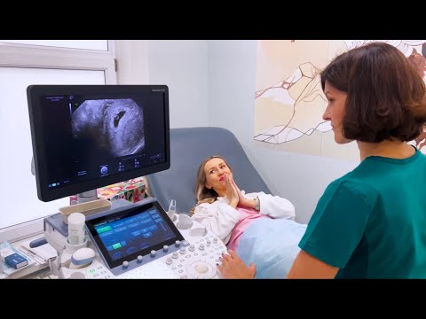 Видео: Результат ХГЧ и моего 7 переноса