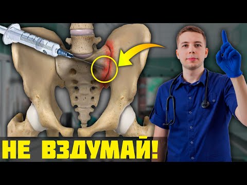 Видео: Болит Крестцово-подвздошный сустав? ГЛАВНАЯ ошибка большинства…