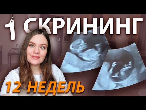 Видео: 1 скрининг беременных | УЗИ 12 недель | Что видно на скрининге первого триместра? Пол ребенка