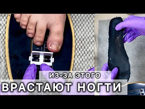Видео: у ТЕБЯ такая обувь? ПОСЛЕДСТВИЯ тут