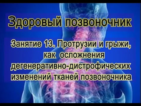 Видео: Занятие 13. Протрузии и грыжи в больном позвоночнике при ДДИ.