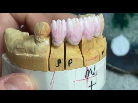 Видео: Как построить фарфоровый мост #7#8#9#10