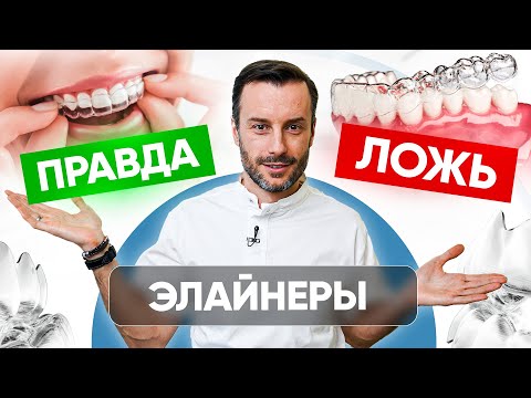 Видео: Элайнеры - что правда, а что ложь? Современная ортодонтия