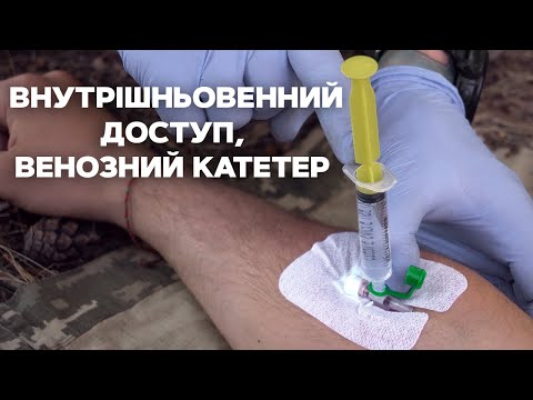 Видео: C-01 Внутрішньовенний доступ, венозний катетер