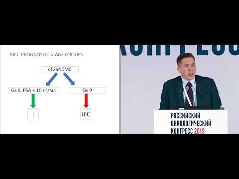 Видео: Онкоурология. Рак предстательной железы. Взгляд лучевого терапевта